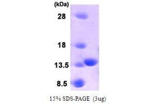 PLA2G16 Protein (AA 1-133)