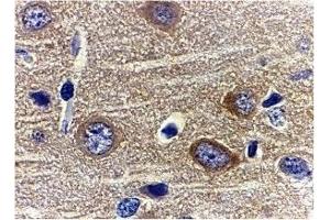 Immunohistochemistry (IHC) image for anti-Adiponectin (ADIPOQ) (N-Term) antibody (ABIN1031215) (ADIPOQ 抗体  (N-Term))