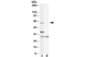 Western blot testing of HeLa cell lysate with PRPF31 antibody at 1ug/ml with [B] and without [A] blocking/immunizing peptide. (PRPF31 抗体)