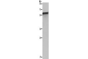 Western Blotting (WB) image for anti-FK506 Binding Protein 8, 38kDa (FKBP8) antibody (ABIN2430123) (FKBP8 抗体)