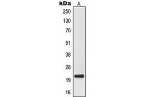 Western blot analysis of MRPL32 expression in HepG2 (A) whole cell lysates. (MRPL32 抗体  (Center))