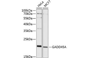Western blot analysis of extracts of various cell lines, using GA antibody (ABIN6130412, ABIN6140923, ABIN6140926 and ABIN6215461) at 1:1000 dilution. (GADD45A 抗体  (AA 1-165))