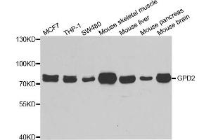 Western blot analysis of extracts of various cell lines, using GPD2 antibody (ABIN5973974) at 1/1000 dilution. (GPD2 抗体)