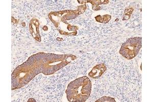 Immunohistochemistry (IHC) image for anti-Keratin 8 (KRT8) (C-Term) antibody (ABIN870549) (KRT8 抗体  (C-Term))