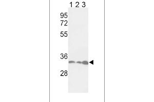 Western blot analysis of PCNA Antibody in Jurkat(lane 1), Hela(lane 2), 293(lane 3) cell line lysates (35ug/lane) (PCNA 抗体  (AA 89-117))