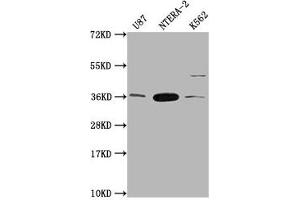 Western Blot Positive WB detected in: U87 whole cell lysate, NTERA-2 whole cell lysate, K562 whole cell lysate All lanes: CBY1 antibody at 1:2000 Secondary Goat polyclonal to rabbit IgG at 1/50000 dilution Predicted band size: 15 kDa Observed band size: 35 kDa (CBY1/PGEA1 抗体  (AA 41-126))