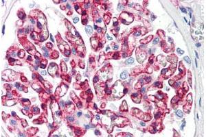 Human Kidney (formalin-fixed, paraffin-embedded) stained with B2M antibody ABIN292915 at 10 ug/ml followed by biotinylated anti-mouse IgG secondary antibody ABIN481714, alkaline phosphatase-streptavidin and chromogen. (beta-2 Microglobulin 抗体)