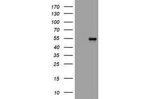 Image no. 6 for anti-Vimentin (VIM) antibody (ABIN1501716) (Vimentin 抗体)