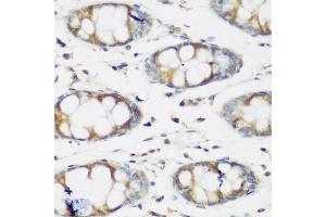 Immunohistochemistry of paraffin-embedded human colon using BMP2 antibody. (BMP2 抗体)