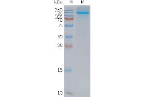 Human L1-Nanodisc, Flag Tag on SDS-PAGE (NPC1L1 蛋白)