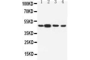 Anti-Dopamine Receptor D3 antibody, Western blotting Lane 1: Rat Testis Tissue Lysate Lane 2: Rat Brain Tissue Lysate Lane 3: U87 Cell Lysate Lane 4: HELA Cell Lysate (DRD3 抗体  (C-Term))