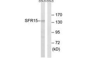 Western blot analysis of extracts from COLO cells, using SFRS15 Antibody. (SCAF4 抗体  (AA 601-650))