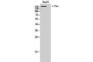 Western Blotting (WB) image for anti-Colony Stimulating Factor 1 Receptor (CSF1R) (Ser275) antibody (ABIN3174363) (CSF1R 抗体  (Ser275))