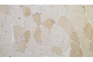 Human skeletal muscle: immunohistochemical staining for Myotilin. (Myotilin 抗体  (C-Term))