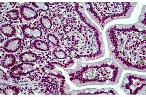 Human Small Intestine: Formalin-Fixed, Paraffin-Embedded (FFPE) (SMARCA4 抗体  (AA 2-14))