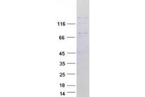 DUOX1 Protein (Transcript Variant 2) (Myc-DYKDDDDK Tag)