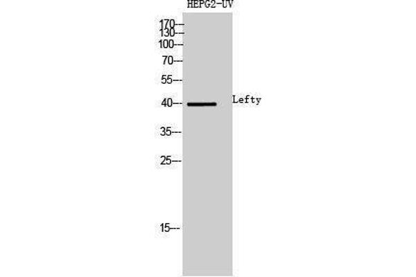 LEFTY1 抗体  (Internal Region)