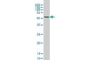 GABPA monoclonal antibody (M01), clone 4B8-G6 Western Blot analysis of GABPA expression in K-562 . (GABPA 抗体  (AA 1-454))