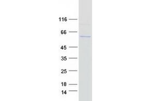 IFIT2 Protein (Myc-DYKDDDDK Tag)