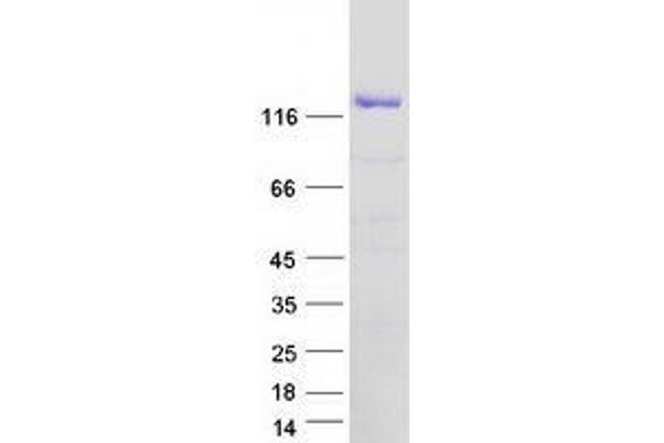 XPO5 Protein (Myc-DYKDDDDK Tag)