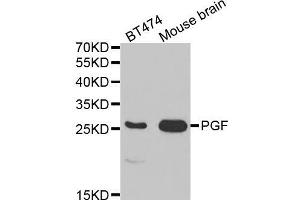 Western blot analysis of extracts of various cell lines, using PGF antibody (ABIN5970864) at 1/1000 dilution. (PLGF 抗体)