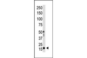 Image no. 1 for anti-Histone 3 (H3) (H3K9me2) antibody (ABIN356586) (Histone 3 抗体  (H3K9me2))