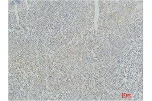 Immunohistochemistry (IHC) analysis of paraffin-embedded Human Tonsil Tissue using Stat4 Polyclonal Antibody. (STAT4 抗体)