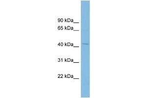 WB Suggested Anti-PTPN2 Antibody Titration: 0. (PTPN2 抗体  (N-Term))