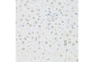Immunohistochemistry of paraffin-embedded rat liver using AKT1 antibody (ABIN5997218) at dilution of 1/100 (40x lens). (AKT1 抗体)