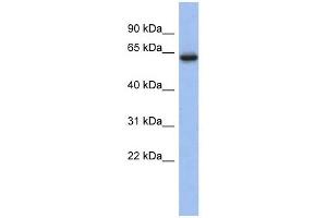 CACNB2 antibody used at 1 ug/ml to detect target protein. (CACNB2 抗体  (Middle Region))