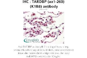 Image no. 3 for anti-TAR DNA Binding Protein (TARDBP) (AA 1-260) antibody (ABIN1723216) (TARDBP 抗体  (AA 1-260))