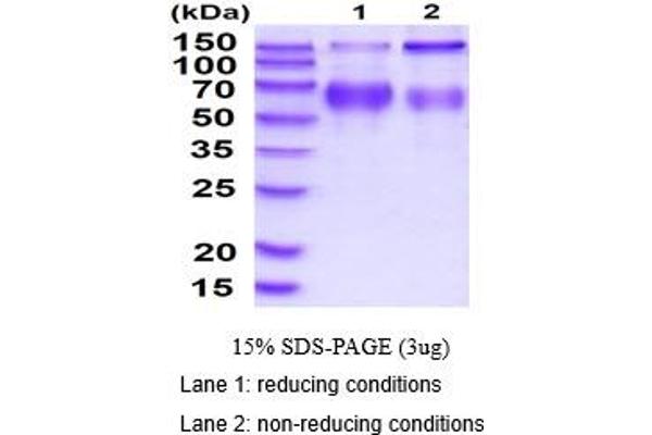 LAMP2 Protein (AA 26-379) (His tag)