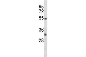 RIPK3 antibody western blot analysis in K562 lysate. (RIPK3 抗体  (AA 480-509))