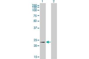 Western Blot analysis of RCV1 expression in transfected 293T cell line by RCV1 monoclonal antibody (M08), clone 4C10. (Recoverin 抗体  (AA 101-199))