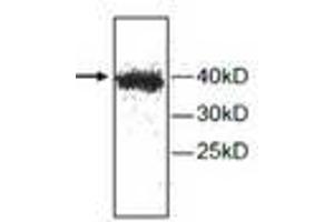 Image no. 1 for anti-Cathepsin H (CTSH) antibody (ABIN791523) (Cathepsin H 抗体)