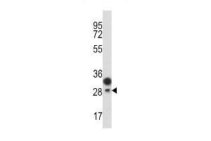 Western blot analysis of C antibody (Center) (ABIN389416 and ABIN2839501) in T47D cell line lysates (35 μg/lane). (PROCR 抗体  (AA 104-132))