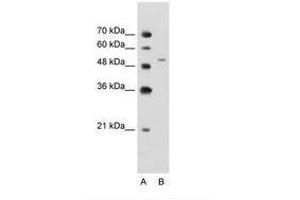 Image no. 2 for anti-Nicotinamide phosphoribosyltransferase (NAMPT) (C-Term) antibody (ABIN203416) (NAMPT 抗体  (C-Term))