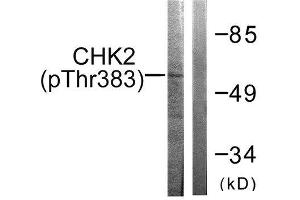 Western Blotting (WB) image for anti-Checkpoint Kinase 2 (CHEK2) (pThr383) antibody (ABIN1847336) (CHEK2 抗体  (pThr383))