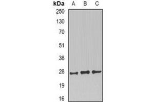 Western blot analysis of CD230 expression in SKOV3 (A), mouse brain (B), mouse kidney (C) whole cell lysates. (PRNP 抗体)