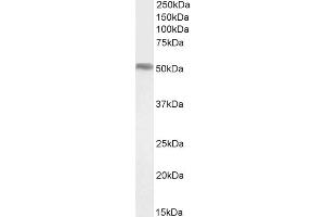 Western Blotting (WB) image for anti-Forkhead Box A1 (FOXA1) (C-Term) antibody (ABIN185021)