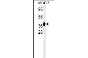 ATG4B/M antibody (ABIN659121 and ABIN2843761) western blot analysis in MCF-7 cell line lysates (35 μg/lane). (ATG4B 抗体)
