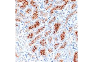 Immunohistochemistry of paraffin-embedded mouse kidney using Syntaxin 3 Rabbit mAb (ABIN7270686) at dilution of 1:100 (40x lens). (STX3 抗体)