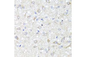 Immunohistochemistry of paraffin-embedded rat brain using IL33 antibody (ABIN5995447) at dilution of 1/100 (40x lens). (IL-33 抗体)