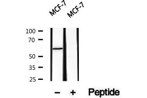 Western blot analysis of extracts of MCF7 cells, using PKLR antibody. (PKLR 抗体  (Internal Region))