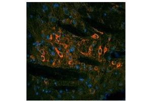 TH antibody used at a concentration of 10 ug/ml to detect substantia nigra and solitary tract in rodent brain (red). (TH 抗体  (N-Term))