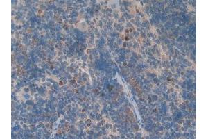 IHC-P analysis of Rat Spleen Tissue, with DAB staining. (GDF3 抗体  (AA 253-366))