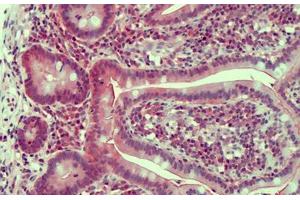 Human Small Intestine: Formalin-Fixed, Paraffin-Embedded (FFPE) (Claudin 2 抗体  (AA 135-164))