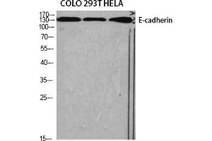 Western Blot analysis of various cells using E-cadherin Polyclonal Antibody diluted at 1:1000. (E-cadherin 抗体  (AA 1-80))