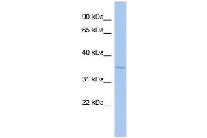 MAGEA9 antibody used at 0. (MAGEA9 抗体  (Middle Region))