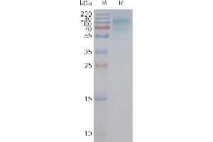 Human A12-Nanodisc, Flag Tag on SDS-PAGE (GLUT12 蛋白)